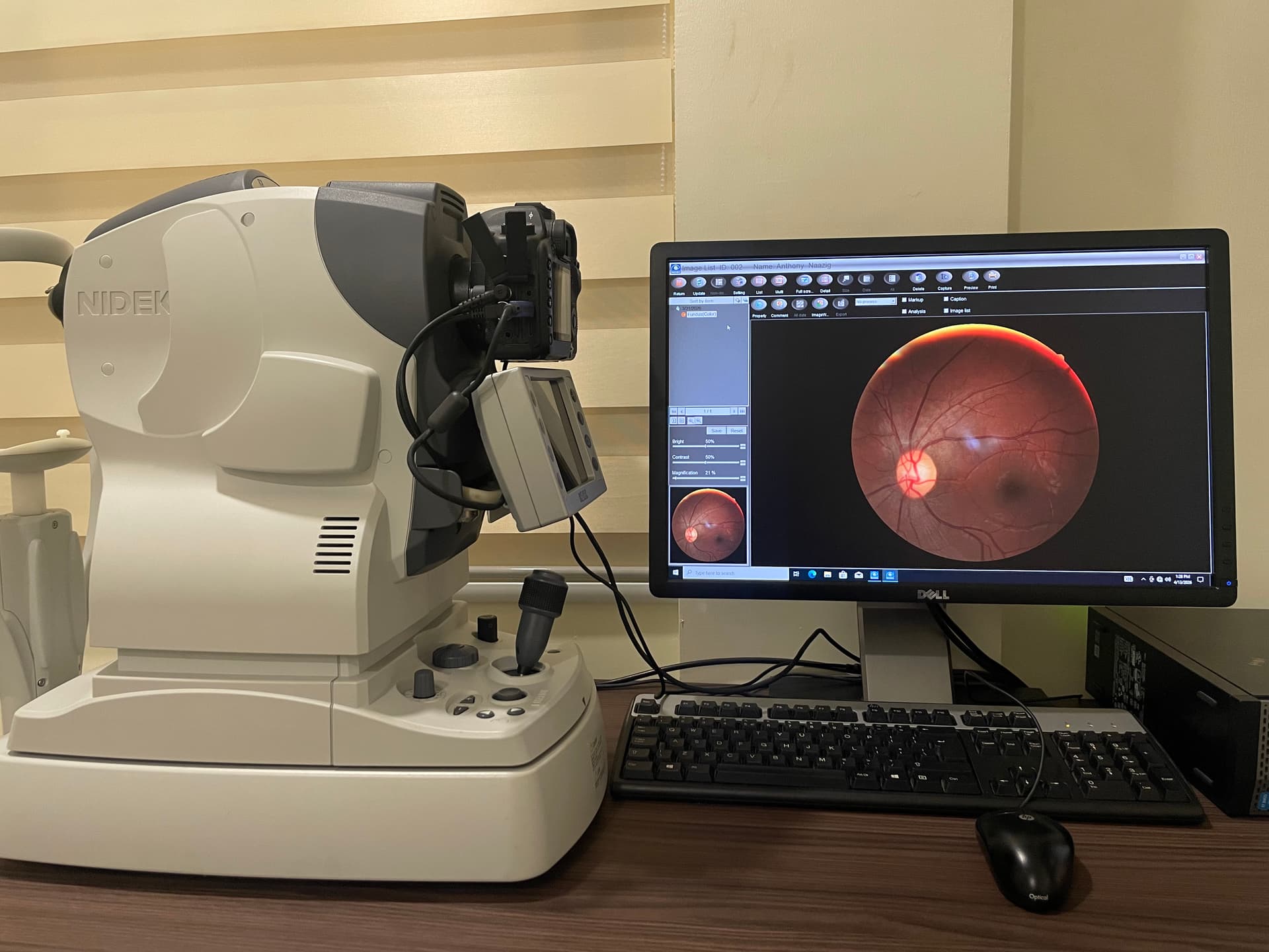 Fundus photography at Lead Opticals
